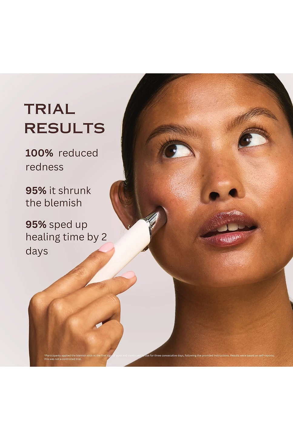 Super Blue Acne Blemish Stick - Image 3